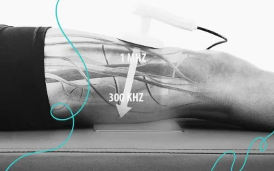 Diatermia para reducir inflamación y acelerar la recuperación: guía completa