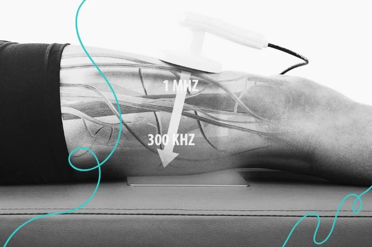 Diatermia para reducir inflamación: guía completa | Valencia