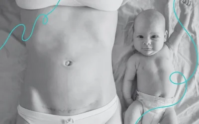 Diatermia para mejorar cicatrices y fibrosis: tratamiento en Valencia