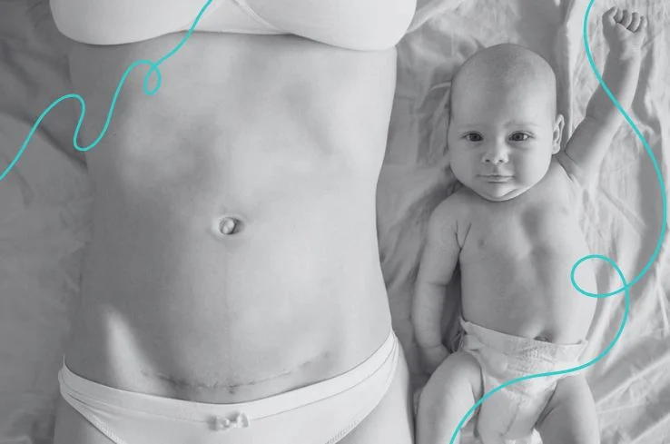 Diatermia para mejorar cicatrices y fibrosis_ tratamiento en Valencia